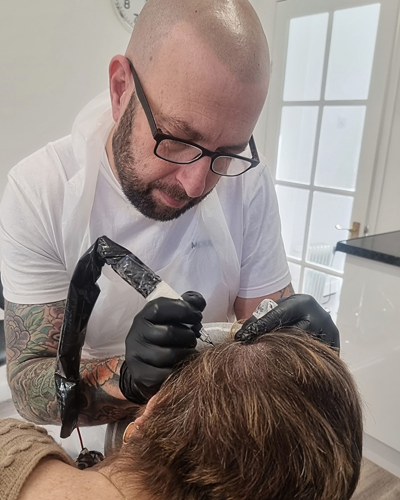 Scalp Micropigmentation (SMP) in Norwich, Norfolk